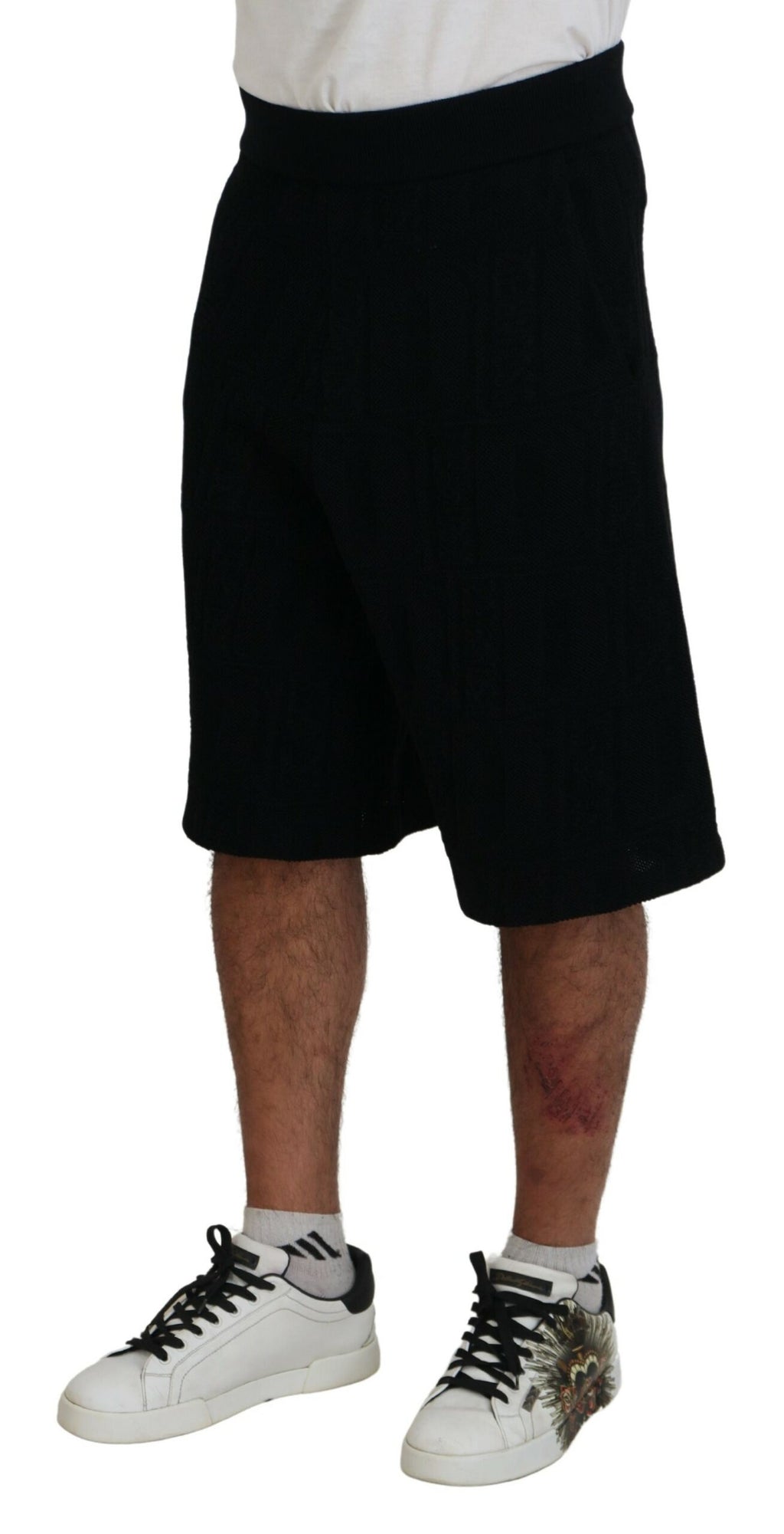 DSQUARED² šortai